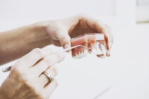 Benefits from Denture Replacement