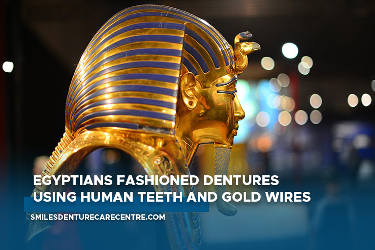Egyptians fashioned dentures using human teeth and gold wires