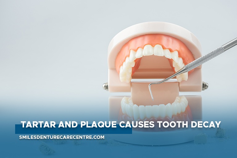 Tartar-and-plaque-causes-tooth-decay