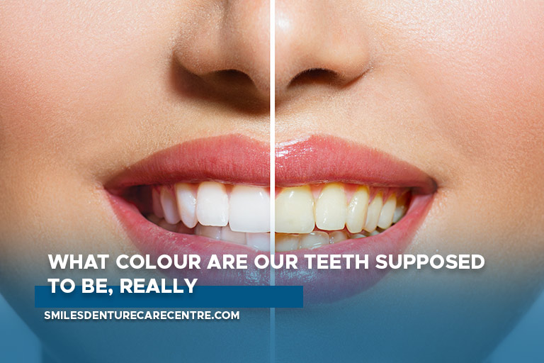 What colour are our teeth supposed to be, really?